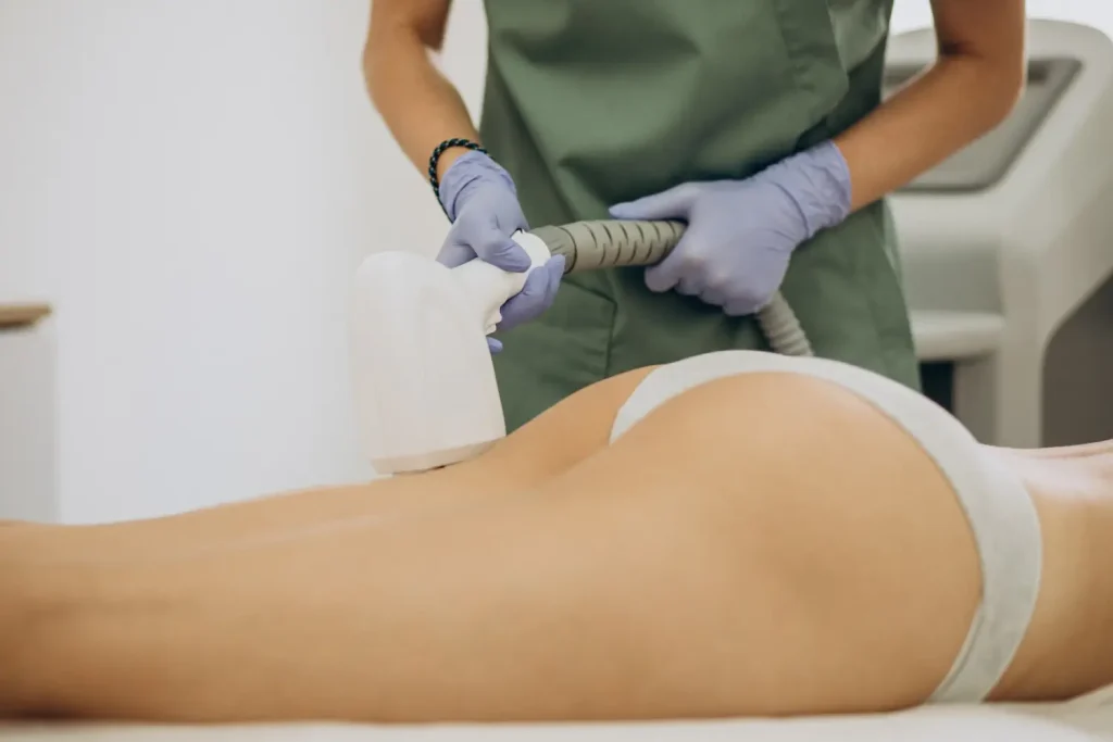 Profesional aplicando tratamiento estético con dispositivo de radiofrecuencia en glúteos para reducir grasa localizada y mejorar firmeza de la piel.