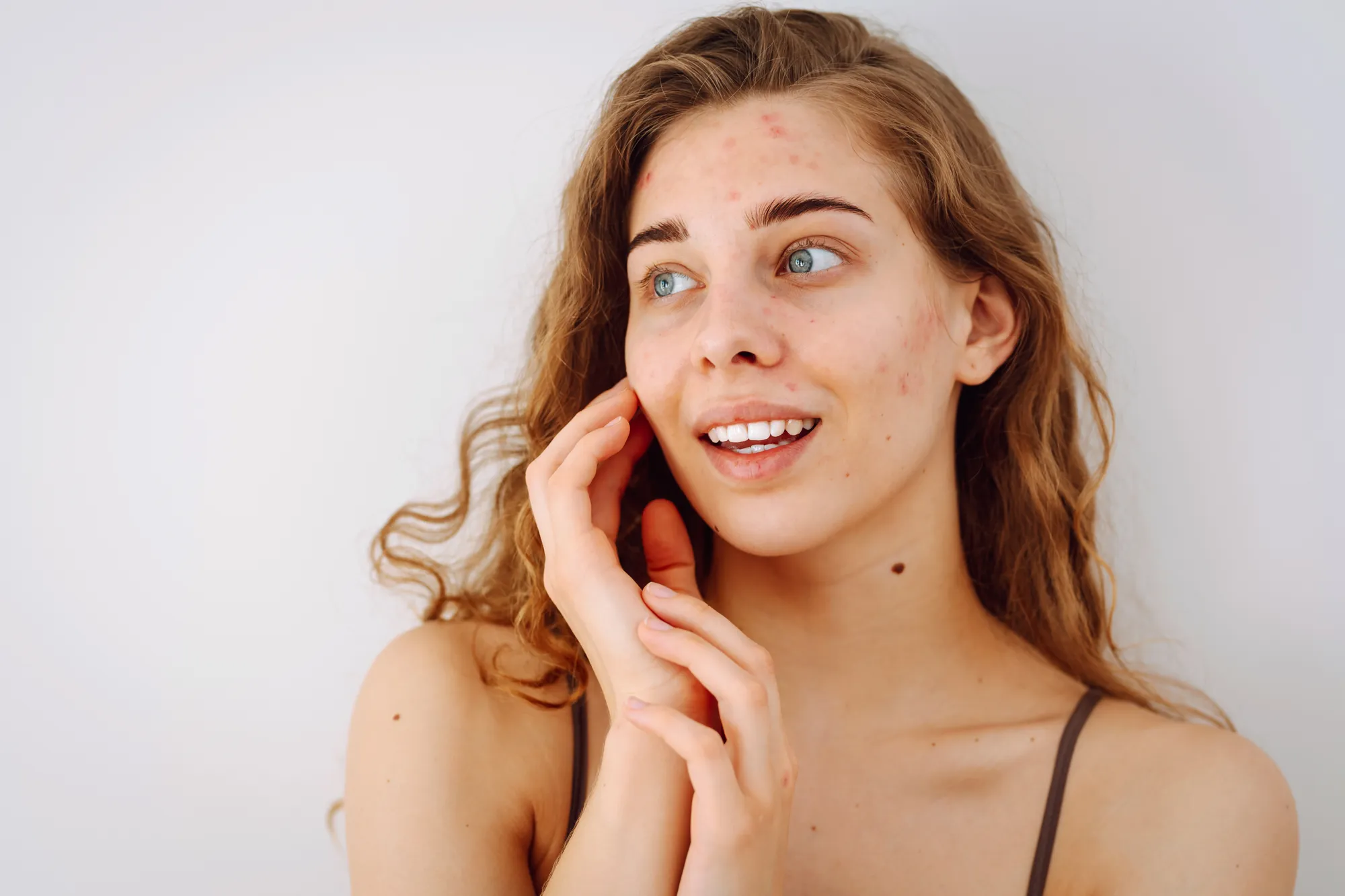 Mujer con manchas en la piel.