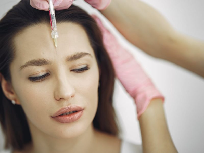 aplicacion de botox en la cara